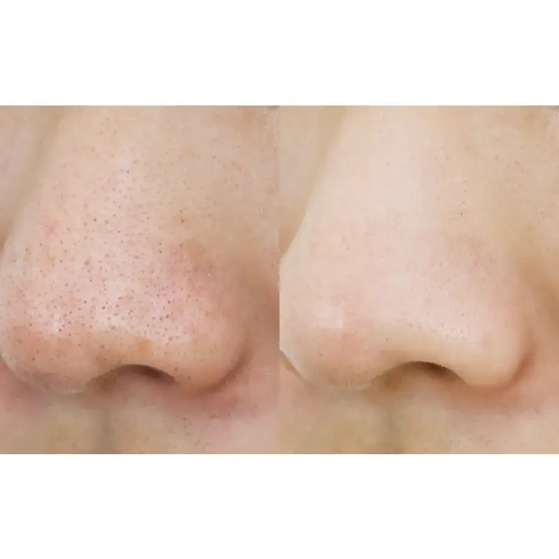 Manyo Factory - Pure Cleansing Oil Double Pack - Image 10